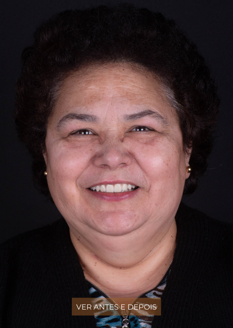 Nunca é tarde para voltar a sorrir com confiança.