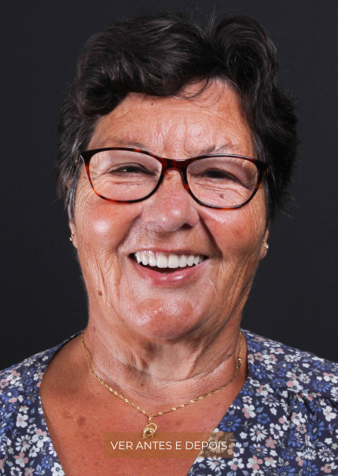 Sorrir com confiança