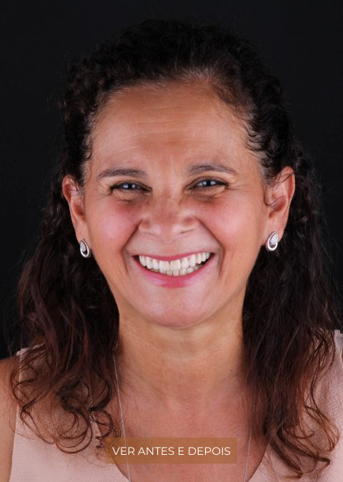 A estética e a funcionalidade de um sorriso natural