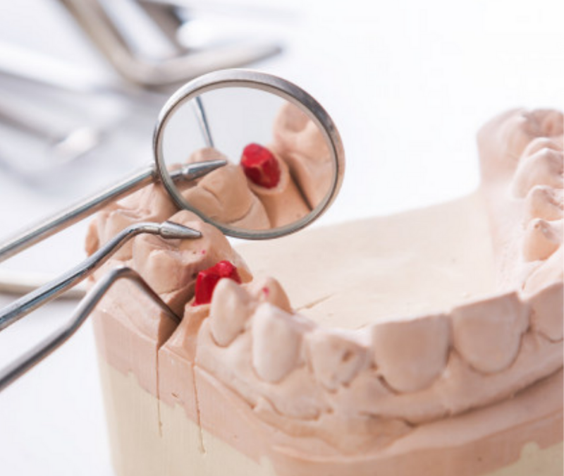 O que é a Periodontologia?