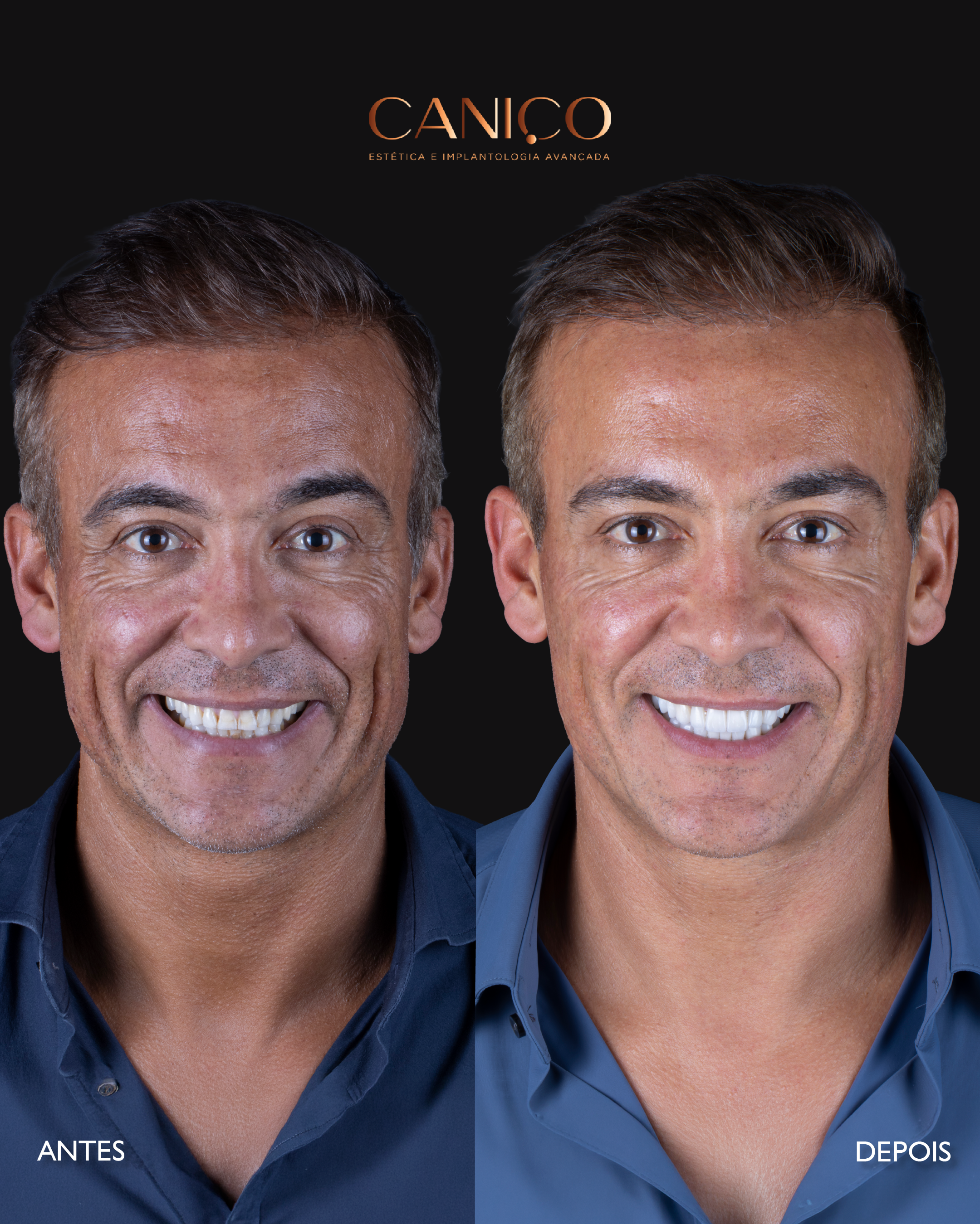 Transformação do sorriso após os 50 anos