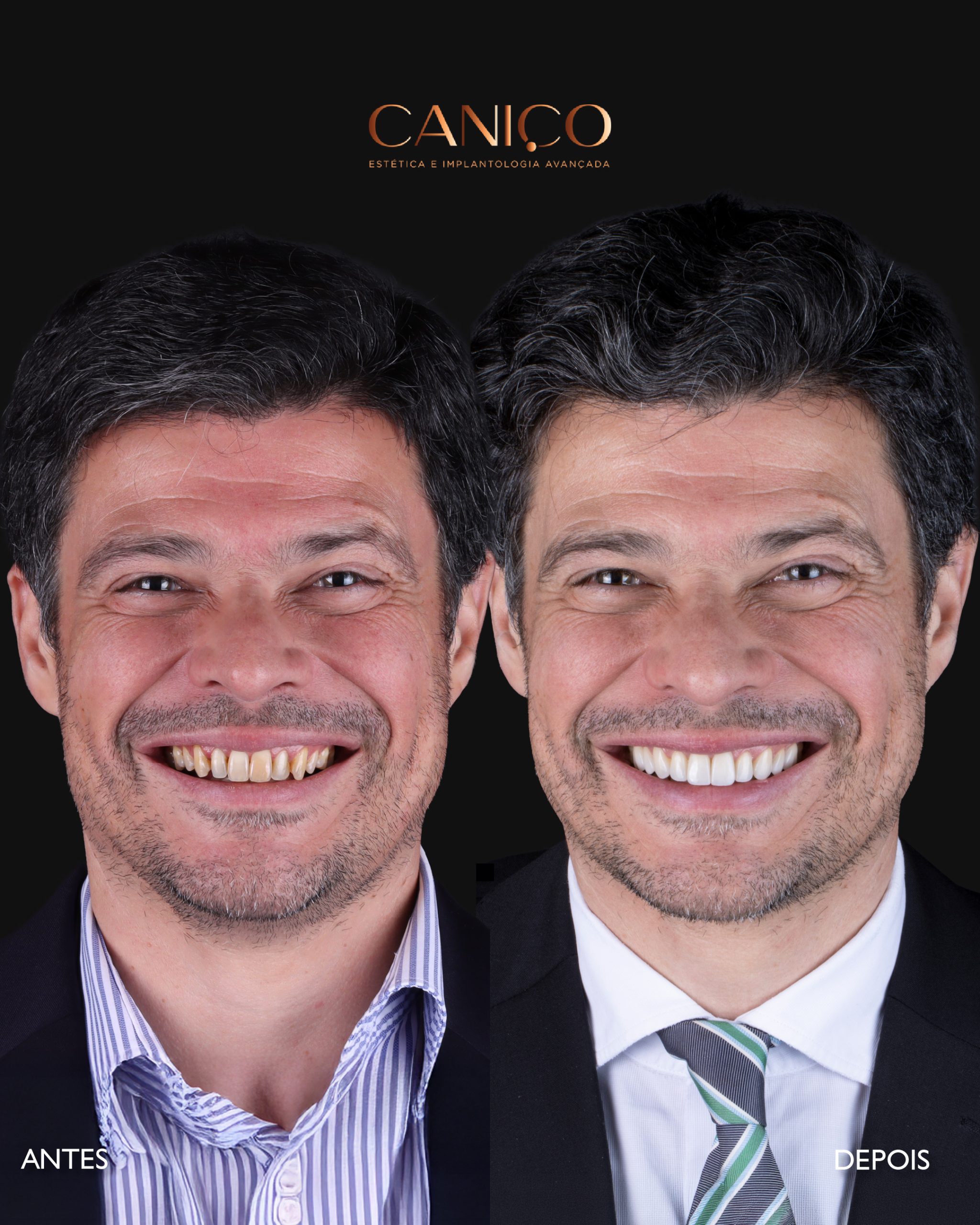 Transformação do sorriso após os 50 anos
