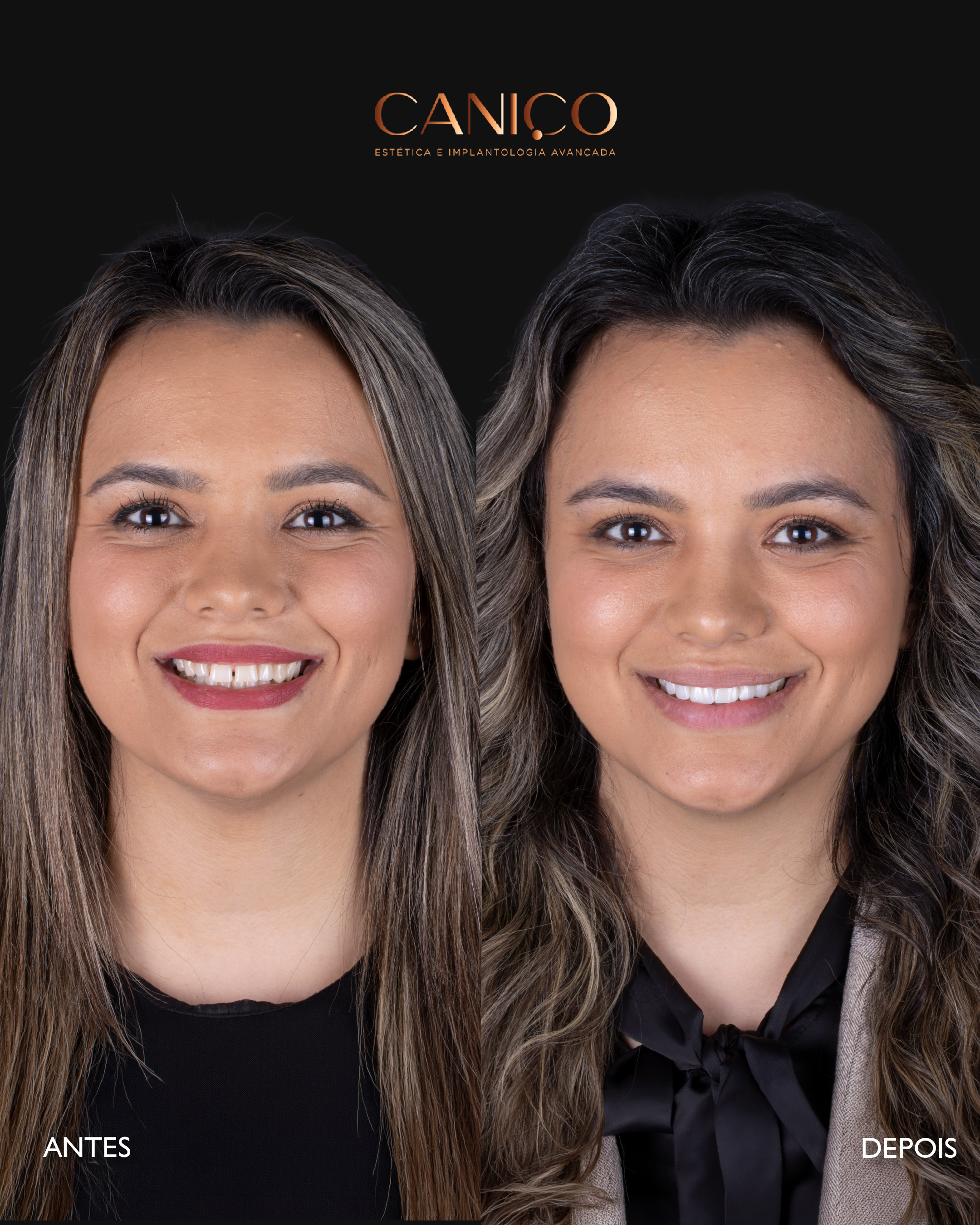 Transformação do sorriso após os 50 anos