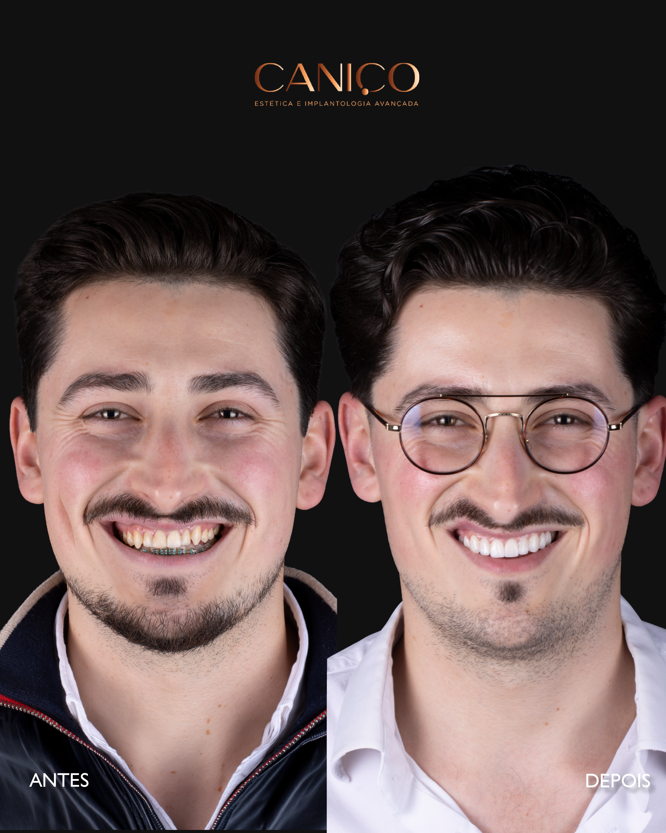 Transformação do sorriso após os 50 anos