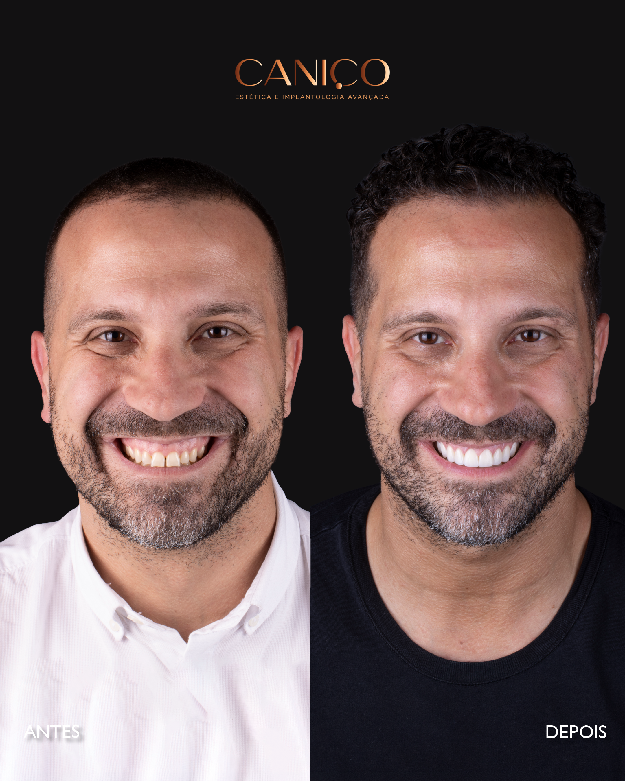 Transformação do sorriso após os 50 anos